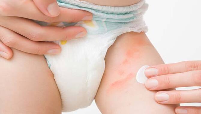 How To Prevent Diaper Rash From Happening