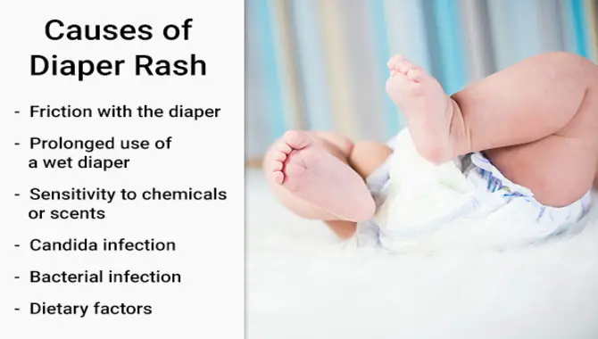 The Causes Of Diaper Rash