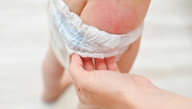 Are There Risk Factors For Diaper Rash