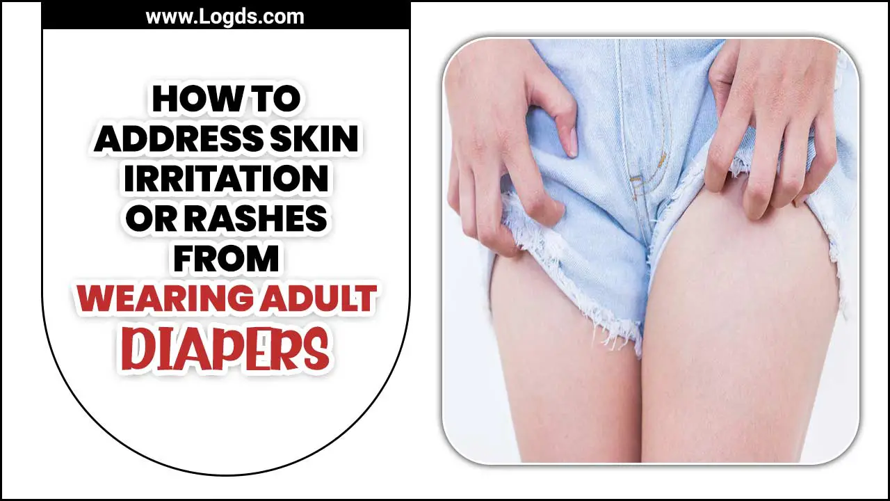 How To Address Skin Irritation Or Rashes From Wearing Adult Diapers