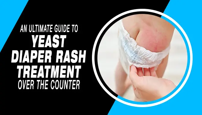 An Ultimate Guide To Yeast Diaper Rash Treatment Over The Counter
