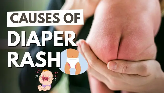 Causes Of Diaper Rash