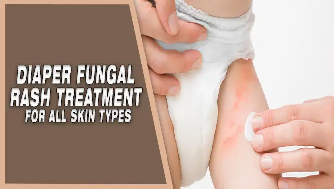 Diaper Fungal Rash Treatment For All Skin Types