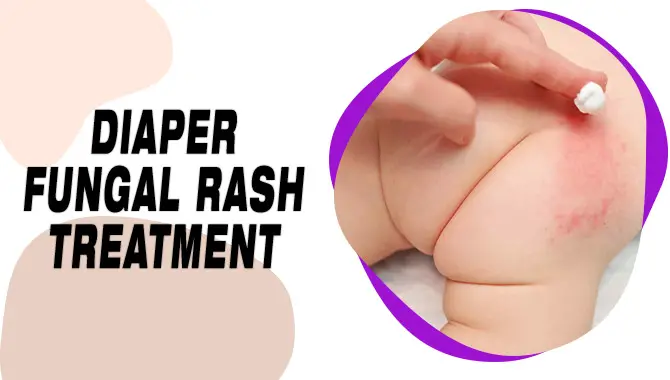 Diaper Fungal Rash Treatment