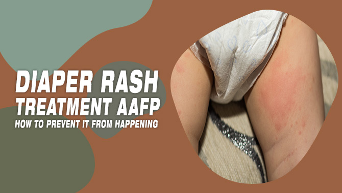 Diaper Rash Treatment Aafp How To Prevent It From Happening