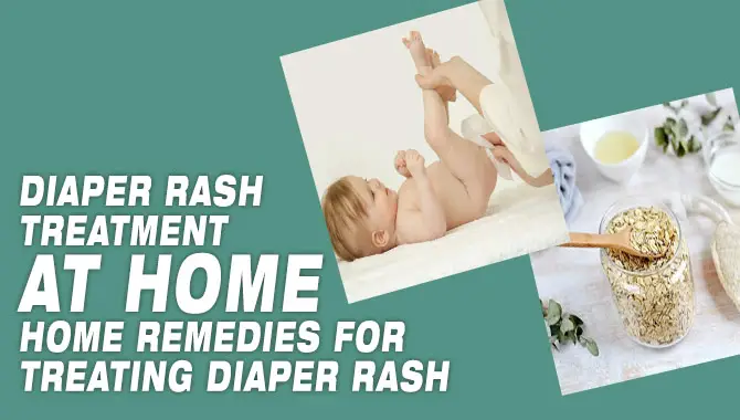 Diaper Rash Treatment At Home Home Remedies For Treating Diaper Rash