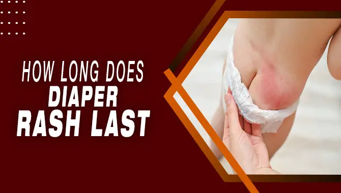 How Long Does Diaper Rash Last