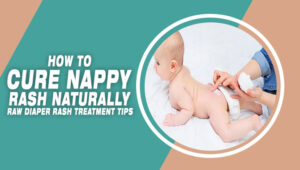 How To Cure Nappy Rash Naturally