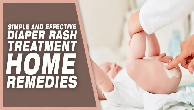 Simple And Effective Diaper Rash Treatment Home Remedies