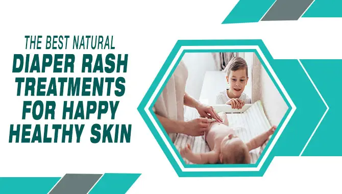 The Best Natural Diaper Rash Treatments For Happy, Healthy Skin