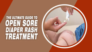 The Ultimate Guide To Open Sore Diaper Rash Treatment