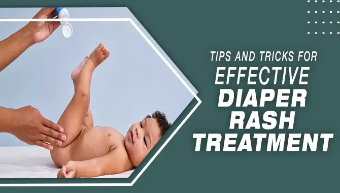 Tips And Tricks For Effective Diaper Rash Treatment